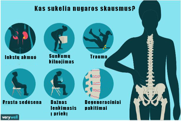 Kas Sukelia Nugaros Skausmus