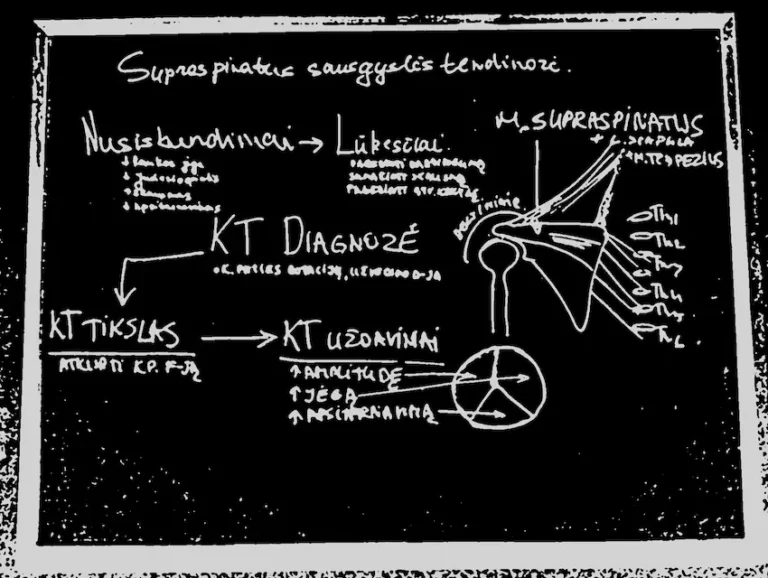 Kineziterapijos Planas Po Peties Sąnario Operacijos Klaipėda