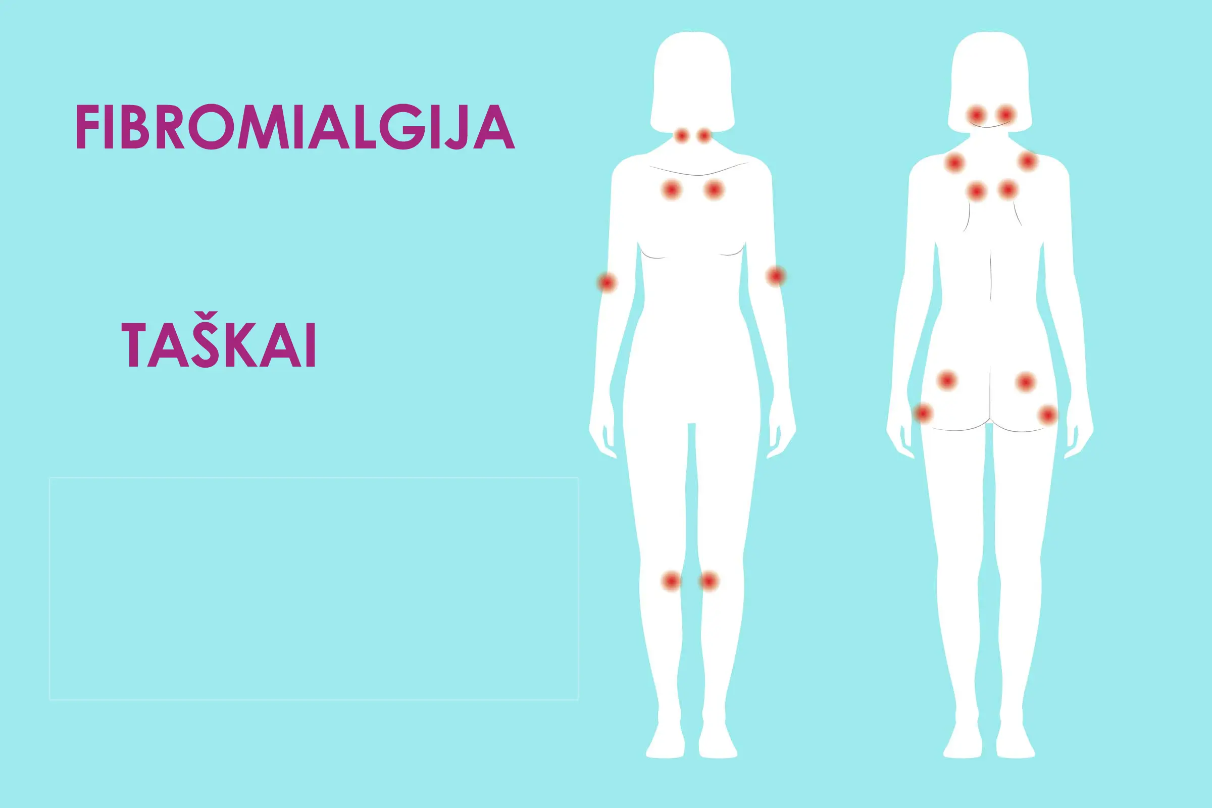 Fibromialgija